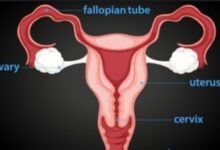 Fallopian tube recanalization surgery: what do you need to know?
